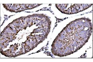 IHC analysis of CAMKIV/Camk4 using anti-CAMKIV/Camk4 antibody (ABIN7600419). (CAMK4 抗体  (AA 19-469))