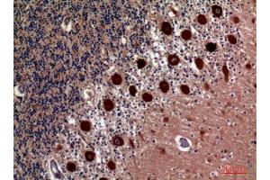 Immunohistochemistry (IHC) analysis of paraffin-embedded Human Brain, antibody was diluted at 1:100. (HSD11B1 抗体  (Internal Region))