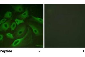 Immunofluorescence analysis of HeLa cells, using PLN polyclonal antibody . (Phospholamban 抗体)