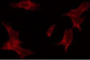 ABIN6274515 staining HuvEc by IF/ICC. (LASS4 抗体  (N-Term))