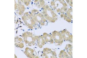 Immunohistochemistry of paraffin-embedded human stomach using SYT4 antibody (ABIN6129135, ABIN6148791, ABIN6148792 and ABIN6223676) at dilution of 1:100 (40x lens). (SYT4 抗体  (AA 38-190))
