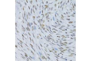 Immunohistochemistry of paraffin-embedded human uterus using SNRNP70 antibody. (SNRNP70 抗体  (AA 150-250))