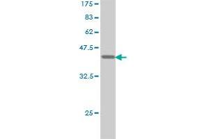 Western Blotting (WB) image for anti-Eukaryotic Translation Initiation Factor 4E Binding Protein 1 (EIF4EBP1) (AA 1-118) antibody (ABIN560717)