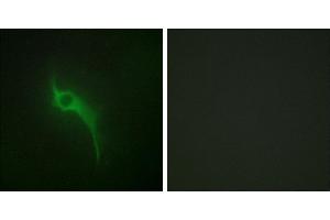 Peptide - +Immunofluorescence analysis of HeLa cells, using Collagen V α1 antibody. (COL5A1 抗体)