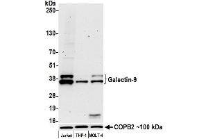 Western Blotting (WB) image for anti-Lectin, Galactoside-Binding, Soluble, 9 (LGALS9) (AA 305-355) antibody (ABIN7449427)