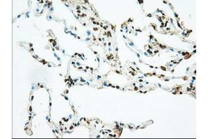 Image no. 7 for anti-Basigin (Ok Blood Group) (BSG) antibody (ABIN1498015) (CD147 抗体)