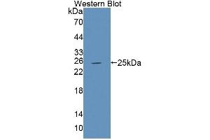 Western blot analysis of the recombinant protein. (PTPRU 抗体  (AA 1263-1446))