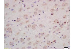 Formalin-fixed and paraffin embedded rat brain labeled with Rabbit Anti-INPPL1 Polyclonal Antibody, Unconjugated (ABIN722200) at 1:200 followed by conjugation to the secondary antibody and DAB staining