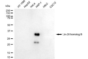 Western blotting analysis using lin-28 homolog B antibody (ABIN7799270). (LIN28B 抗体)
