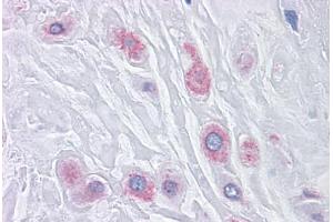 Human Placenta: Formalin-Fixed, Paraffin-Embedded (FFPE) (BUB1B 抗体  (AA 1-130))
