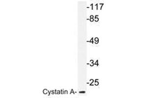 Western blot analysis of Cystatin A antibody in extracts from HT-29 cells. (CSTA 抗体)