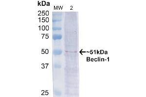 Western blot analysis of Human Cervical cancer cell line (HeLa) lysate showing detection of ~51 kDa Beclin 1 protein using Rabbit Anti-Beclin 1 Polyclonal Antibody (ABIN2868739). (Beclin 1 抗体)