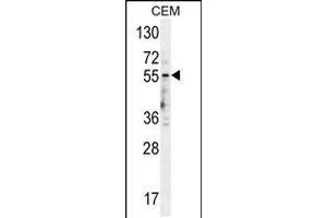 Western blot analysis in CEM cell line lysates (35ug/lane). (HTR3E 抗体  (AA 126-154))