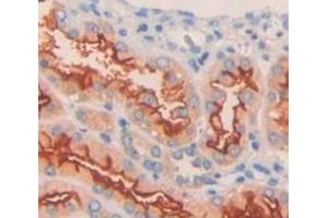 Used in DAB staining on fromalin fixed paraffin- embedded Kidney tissue (KCNJ10 抗体  (AA 165-379))
