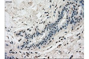 Immunohistochemical staining of paraffin-embedded breast tissue using anti-DHFR mouse monoclonal antibody. (Dihydrofolate Reductase 抗体)