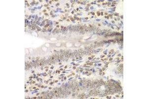 Immunohistochemistry of paraffin-embedded rat Intestine using UHRF2 antibody (ABIN6133264, ABIN6149911, ABIN6149913 and ABIN6217665) at dilution of 1:200 (40x lens). (UHRF2 抗体  (AA 441-622))