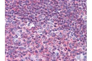 Immunohistochemical analysis of paraffin-embedded human Tonsil tissues using PYK2 mouse mAb. (PTK2B 抗体  (AA 815-997))