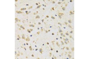 Immunohistochemistry of paraffin-embedded rat brain using RPS12 antibody. (RPS12 抗体  (AA 1-132))