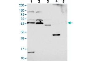 Western blot analysis of Lane 1: RT-4, Lane 2: U-251 MG, Lane 3: Human Plasma, Lane 4: Liver, Lane 5: Tonsil with ACRBP polyclonal antibody  at 1:250-1:500 dilution. (ACRBP 抗体)
