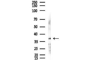 Western blot analysis of lysates from F10-LUC cells(starvation,24h treatment), using AKR1 Antibody at 1/1000 dilution.