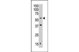 The MAFK polyclonal antibody  is used in Western blot to detect MAFK in Jurkat cell lysate. (Septin 9 抗体  (C-Term))