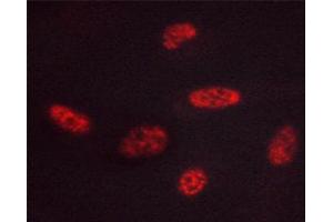 ABIN6267444 staining HUVEC cells by ICC/IF. (GATA3 抗体  (pSer308))