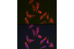 Immunofluorescence analysis of HeLa cells using MYO10 antibody (ABIN6128319, ABIN6144271, ABIN6144274 and ABIN6216113) at dilution of 1:350. (Myosin X 抗体  (AA 845-944))
