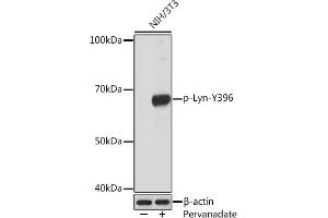 Western blot analysis of extracts of NIH/3T3 cells, using Phospho-Lyn-Y396 Rabbit mAb (ABIN7271269) at 1:1000 dilution. (LYN 抗体  (pTyr396))