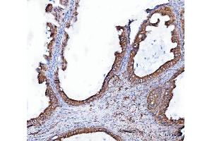 IHC analysis of Heme oxygenase 2/HMOX2 using anti-Heme oxygenase 2/HMOX2 antibody (ABIN7601766).