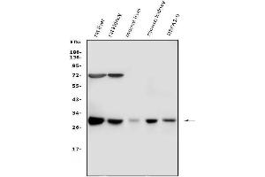 Western blot analysis of Cathepsin G using anti-Cathepsin G antibody (ABIN3044510).