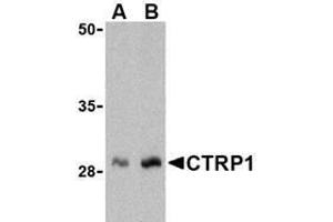 Western blot analysis of CTRP1 in human kidney cell lysate with AP30247PU-N CTRP1 antibody at (A) 1 and (B) 2 μg/ml. (C1QTNF1 抗体  (N-Term))