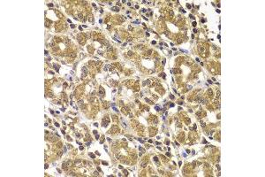 Immunohistochemistry of paraffin-embedded human gastric using HSPE1 antibody. (HSPE1 抗体  (AA 1-102))