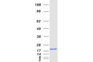 Western Blotting (WB) image for Sorcin (SRI) (Transcript Variant 2) protein (Myc-DYKDDDDK Tag) (ABIN2732365)