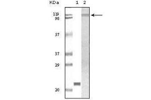 Western blot analysis using TYK2 mouse mAb against truncated TYK2 recombinant protein (1) and Jurkat cell lysate(2). (TYK2 抗体)