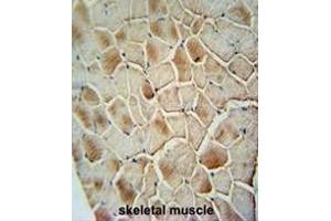 COX10 antibody (C-term) immunohistochemistry analysis in formalin fixed and paraffin embedded human skeletal muscle followed by peroxidase conjugation of the secondary antibody and DAB staining. (COX10 抗体  (C-Term))