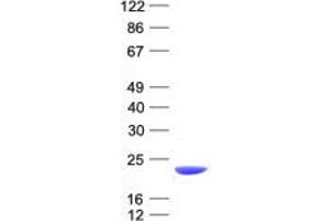 Validation with Western Blot (NAT5 Protein (His tag))