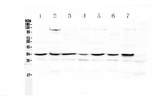 Western blot analysis of UCP2 using anti-UCP2 antibody . (UCP2 抗体  (Middle Region))
