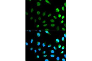Immunofluorescence analysis of HeLa cell using NEDD8 antibody. (NEDD8 抗体)