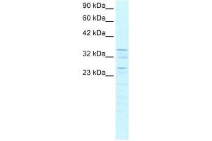 WB Suggested Anti-ZNF385 Antibody Titration: 0. (ZNF385A 抗体  (C-Term))