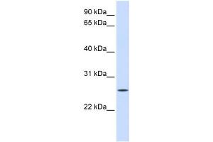 WB Suggested Anti-UNC50 Antibody Titration:  0.