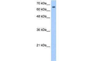 WB Suggested Anti-SYVN1 Antibody Titration:  1. (SYVN1 抗体  (Middle Region))