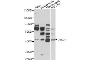 Western blot analysis of extracts of various cell lines, using UTS2R antibody (ABIN1875304) at 1:1000 dilution. (UTS2R 抗体)