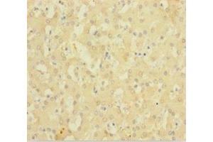 Immunohistochemistry of paraffin-embedded human liver tissue using ABIN7143220 at dilution of 1:100 (Diazepam Binding Inhibitor 抗体  (AA 2-105))