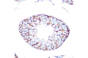 Immunohistochemistry of paraffin-embedded rat testis using Muscarinic AChR M2 (Muscarinic AChR M2 ) Rabbit mAb (ABIN7266346) at dilution of 1:100 (40x lens). (Muscarinic Acetylcholine Receptor M2 抗体)