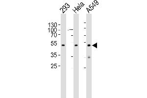 Western blot analysis of lysates from 293, Hela, A549 cell line (from left to right), using CBX8 Antibody (C-term) (ABIN6242216 and ABIN6577075). (CBX8 抗体  (C-Term))