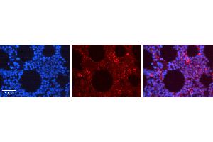Rabbit Anti-EPOR Antibody   Formalin Fixed Paraffin Embedded Tissue: Human Bone Marrow Tissue Observed Staining: Cytoplasm, Plasma membrane Primary Antibody Concentration: 1:100 Other Working Concentrations: N/A Secondary Antibody: Donkey anti-Rabbit-Cy3 Secondary Antibody Concentration: 1:200 Magnification: 20X Exposure Time: 0. (EPOR 抗体  (N-Term))