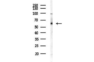 Western blot analysis of lysates from HUVEC cells(starvation,24h treatment), using LILR Antibody at 1/1000 dilution.