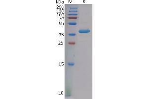 Human C Protein, hFc Tag on SDS-PAGE under reducing condition.
