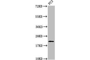 Western Blot Positive WB detected in: PC-3 whole cell lysate All lanes: HIST1H1D antibody at 1 μg/mL Secondary Goat polyclonal to rabbit IgG at 1/50000 dilution Predicted band size: 23 kDa Observed band size: 23 kDa (Histone H1.3 抗体  (pThr146))