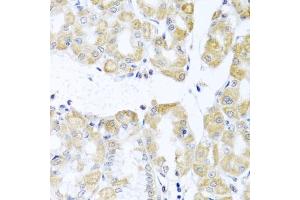 Immunohistochemistry of paraffin-embedded human stomach using DDX39A antibody (ABIN6131590, ABIN6139489, ABIN6139491 and ABIN6223963) at dilution of 1:100 (40x lens). (DDX39 抗体  (AA 178-427))